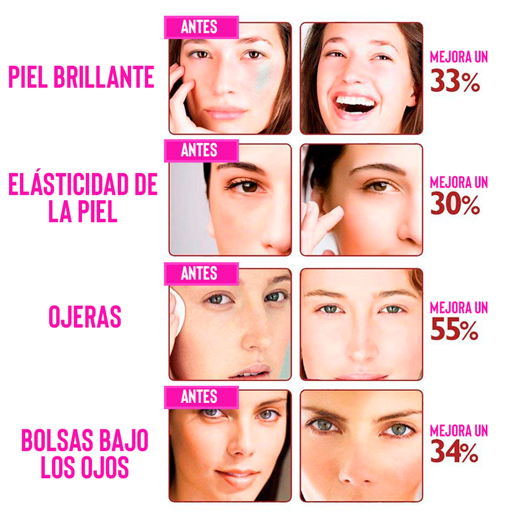 Dispositivo Anti-Arrugas Iónico — Tu Spa Facial en Casa