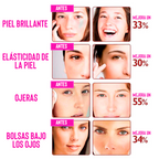 Dispositivo Anti-Arrugas Iónico — Tu Spa Facial en Casa