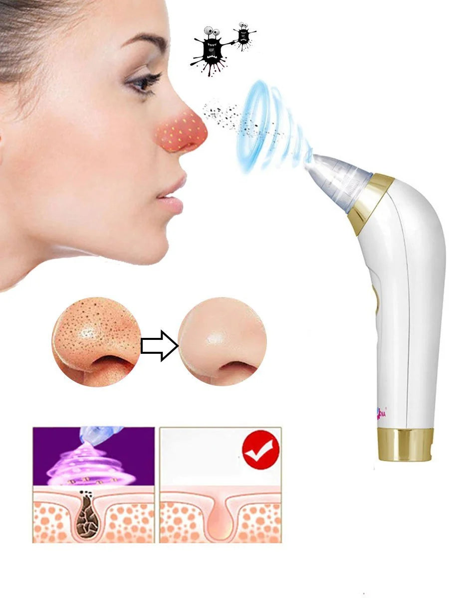 Extractor de Puntos Negros — Di Adiós a los Poros Obstruidos Para Siempre 🔬✨