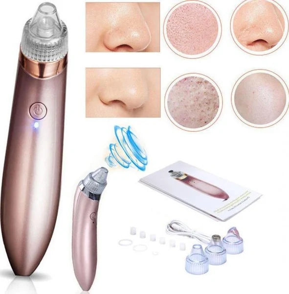 Extractor de Puntos Negros — Di Adiós a los Poros Obstruidos Para Siempre 🔬✨