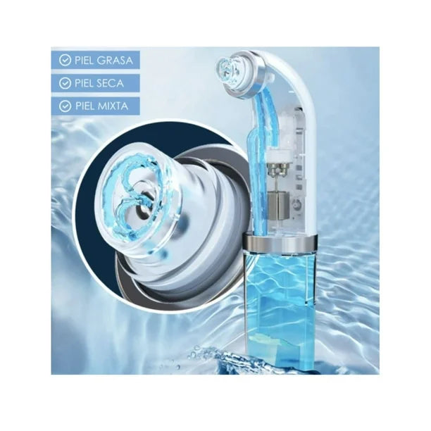 extractor de espinillas a vapor