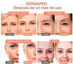 Máquina Dermapen Profesional — Rejuvenece tu Piel desde Casa ✨