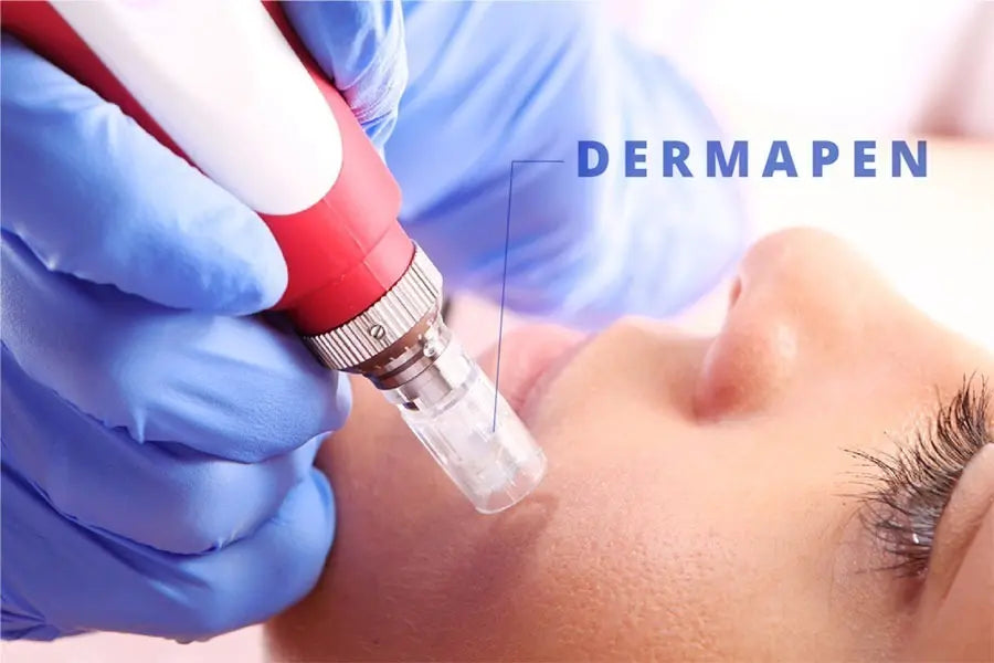 Máquina Dermapen Profesional — Rejuvenece tu Piel desde Casa ✨