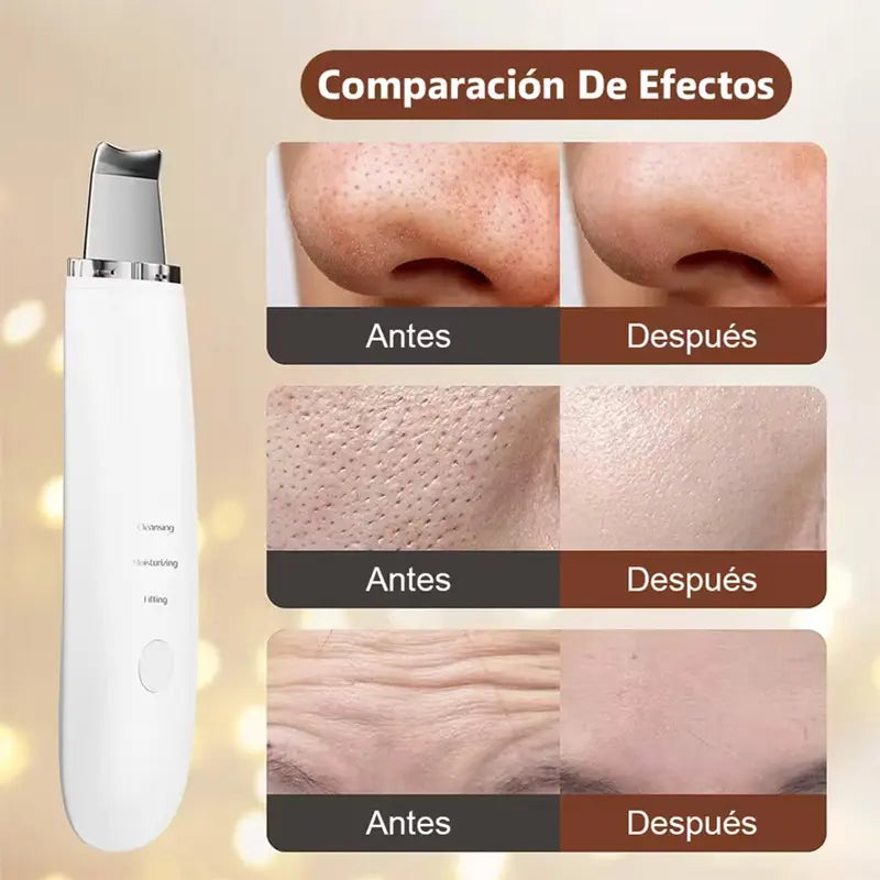 Pala Facial Exfoliante Ultrasónica