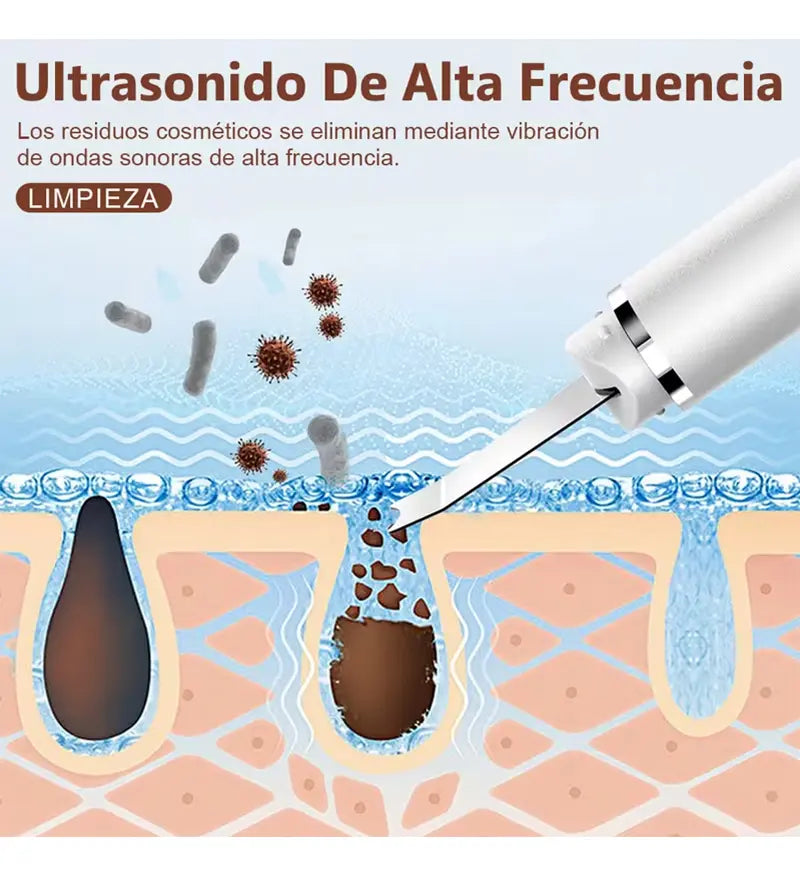 Pala Facial Exfoliante Ultrasónica