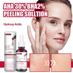Sérum Anti-Acné AHA+BHA — Piel Clara en 7 Días