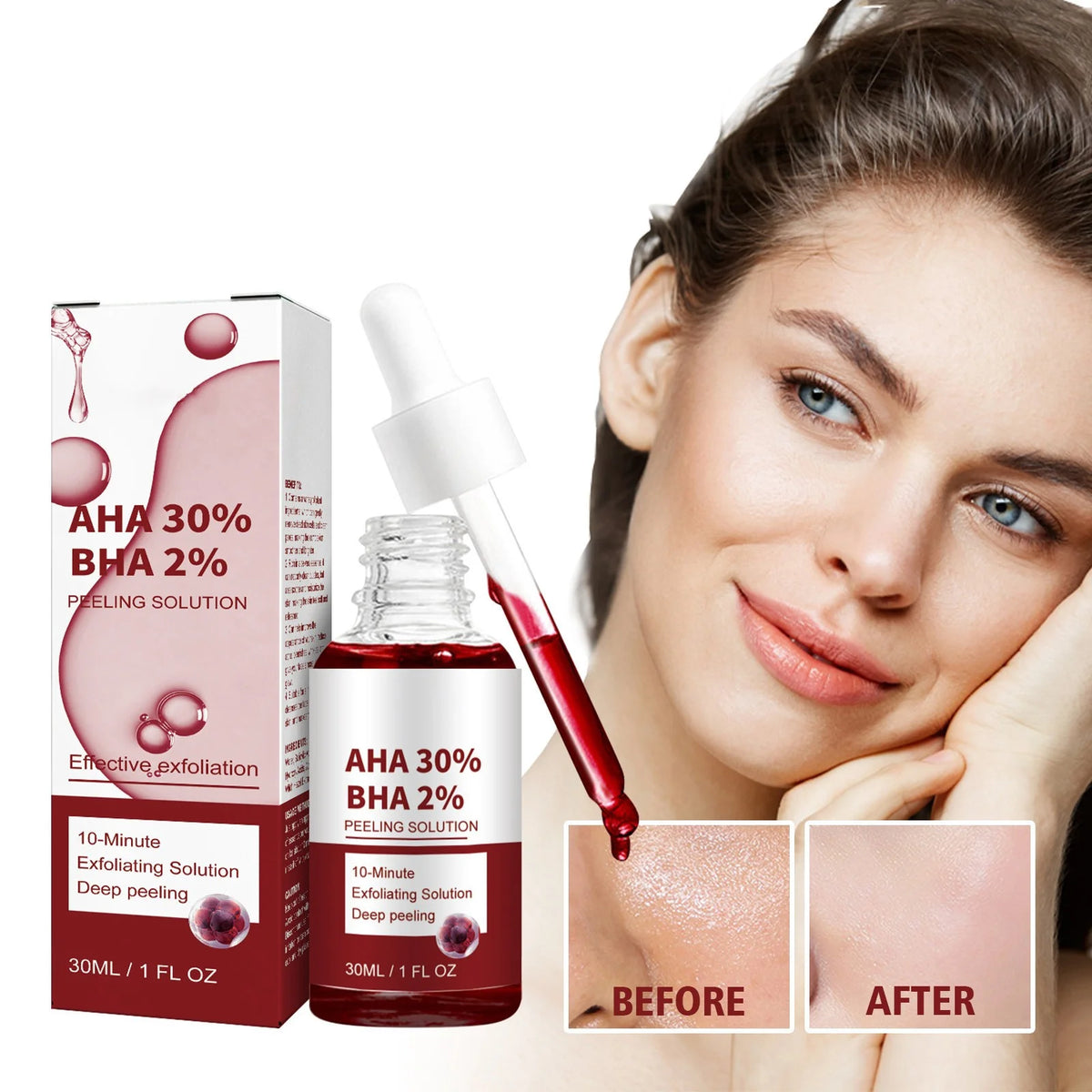Sérum Anti-Acné AHA+BHA — Piel Clara en 7 Días
