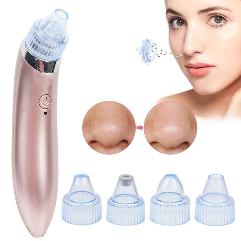 Extractor de Puntos Negros — Di Adiós a los Poros Obstruidos Para Siempre 🔬✨